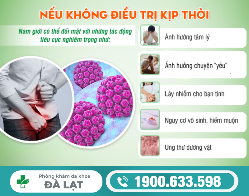 Hình ảnh minh họa